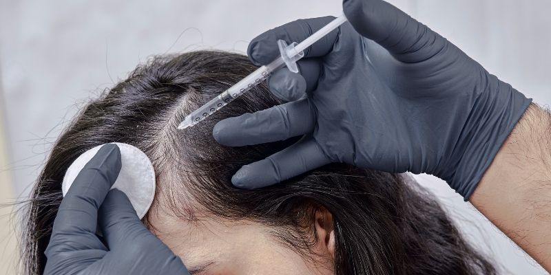 Do PRP and Mesotherapy Grow Hair? All the Facts