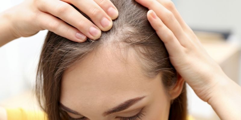 How is Hair Transplant Done in Women? What are the Differences?