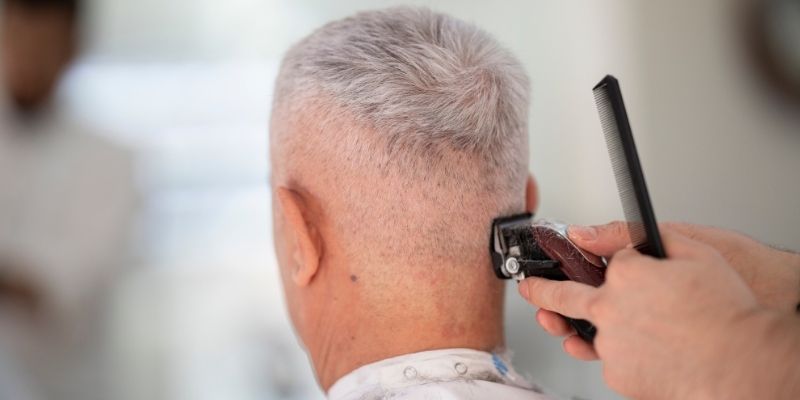 What is the Right Timing for a Hair Transplant?