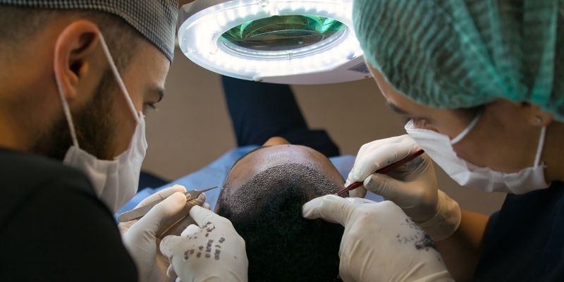 How to Do the First Wash After Hair Transplant?