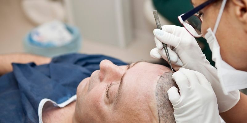 BestHairClinic: Step-by-Step Guide for Hair Transplant Day
